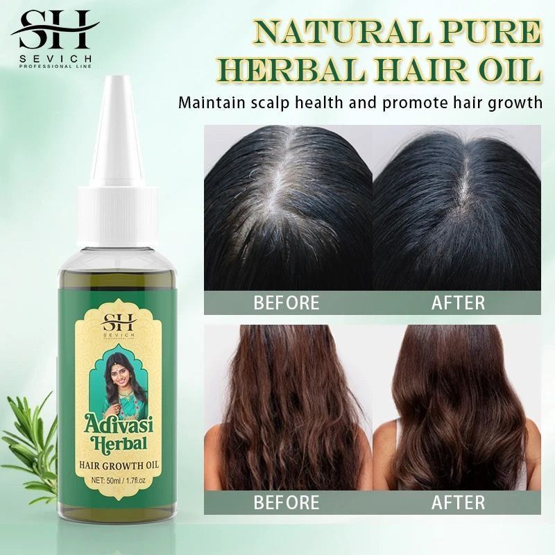 아유르베다 헤어 성장 오일 인도 아디바시 유기농 헤어  - Ayurvedic & Herbal Wellness Kits 리뷰 및 가격